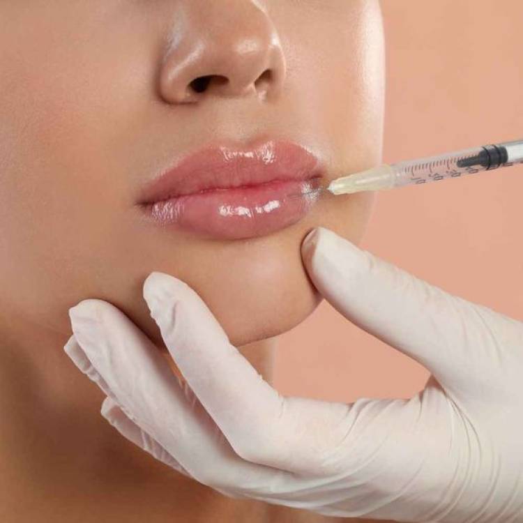 Lip Filler: Všechno, co potřebujete vědět o zvětšení rtů kyselinou hyaluronovou